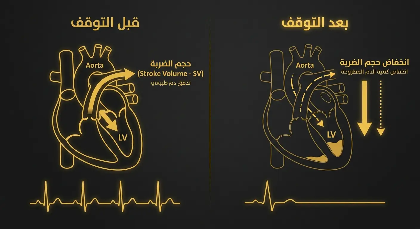 رسم توضيحي يبين انخفاض حجم الضربة القلبية بعد أسبوعين من التوقف عن التدريب، وهو أحد الأسباب الرئيسية لتراجع VO2max